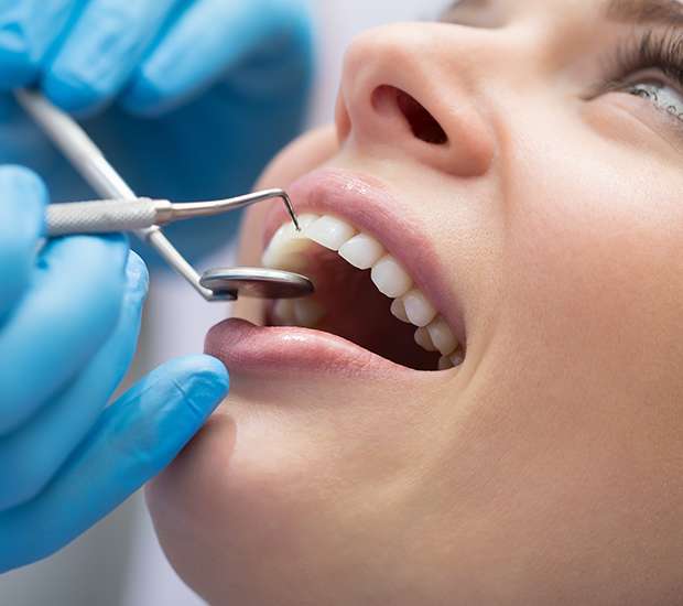 Normal Dental Bonding