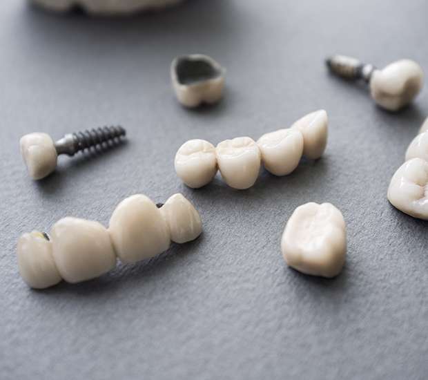 Normal The Difference Between Dental Implants and Mini Dental Implants