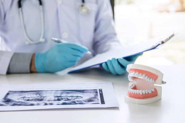 Oral Cancer Screening Normal, IL