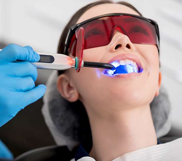 Normal Professional Teeth Whitening