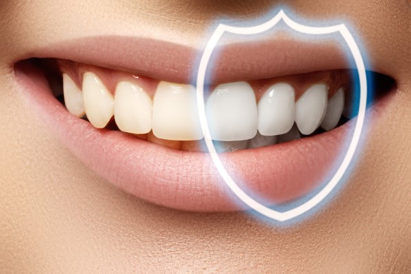 Tips For Zoom Teeth Whitening Aftercare